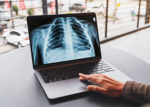 x-ray record retrieval