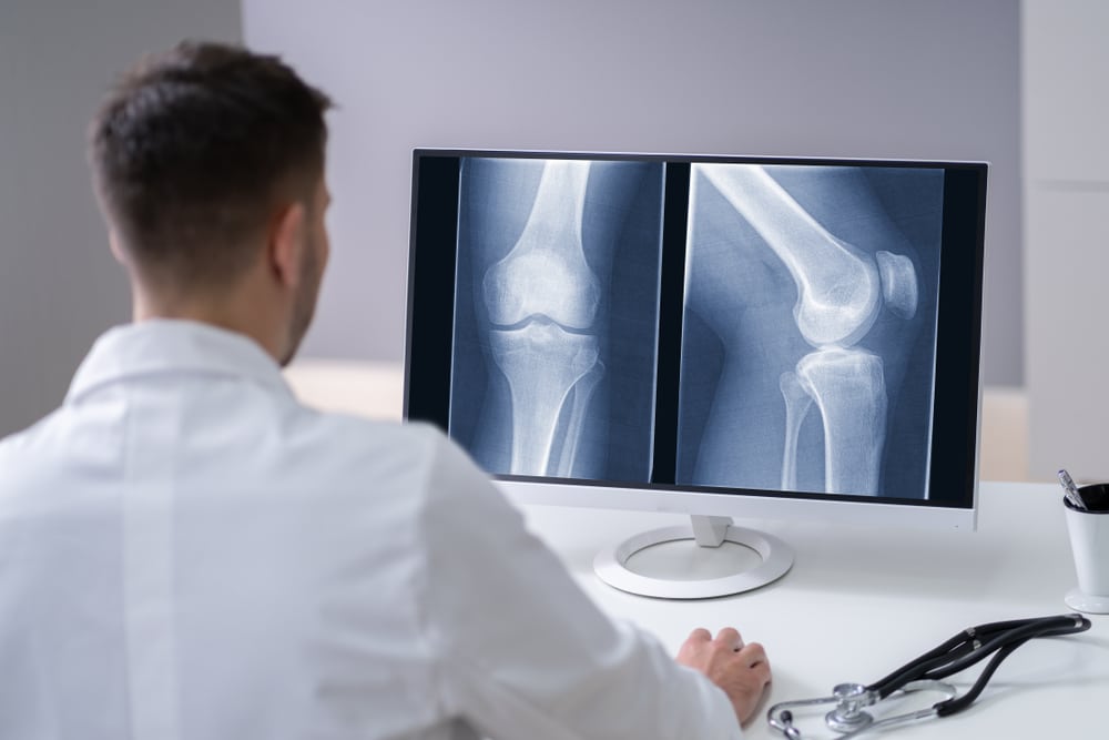 AI for xray record retrieval